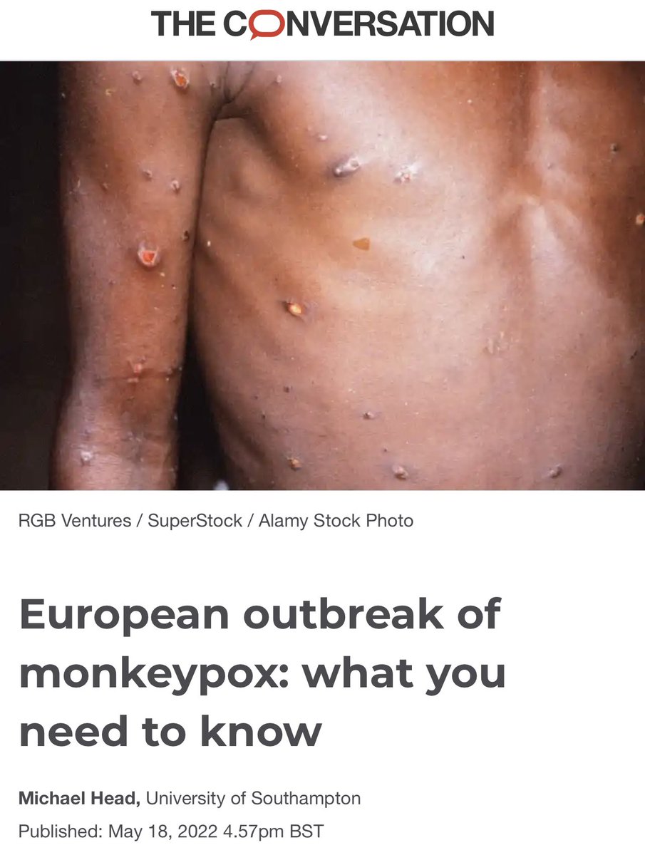 Here we go again demonizing #Africa as “the infectious continent”. The narrative of disease reporting is overwhelmingly biased! 

Look at the nature of reporting about #MonkeypoxVirus … #NoMore