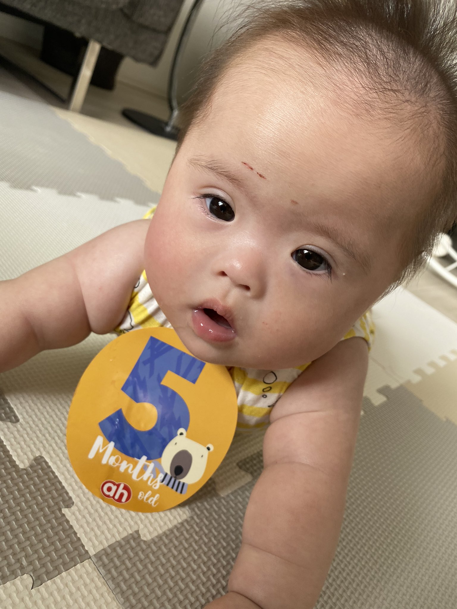 いっちゃんママ 21t Girl 娘の二重でくりくりお目目 寝顔のつり目なとこも低い鼻も性格も他にもたくさん私や夫 家族に似てるのよ ダウン症の特徴って言われればそうなんだけど ダウン症だからじゃなくて私達に似たの まぁ 何が言いたいか