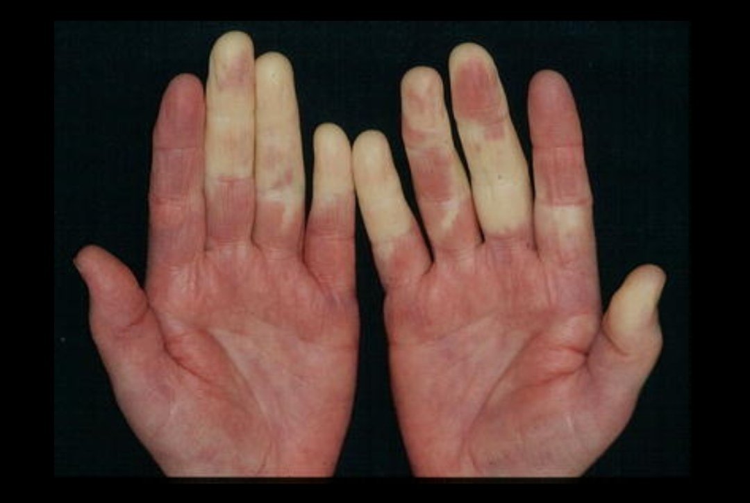 -¿Cómo se dice justo ahora en inglés?
-