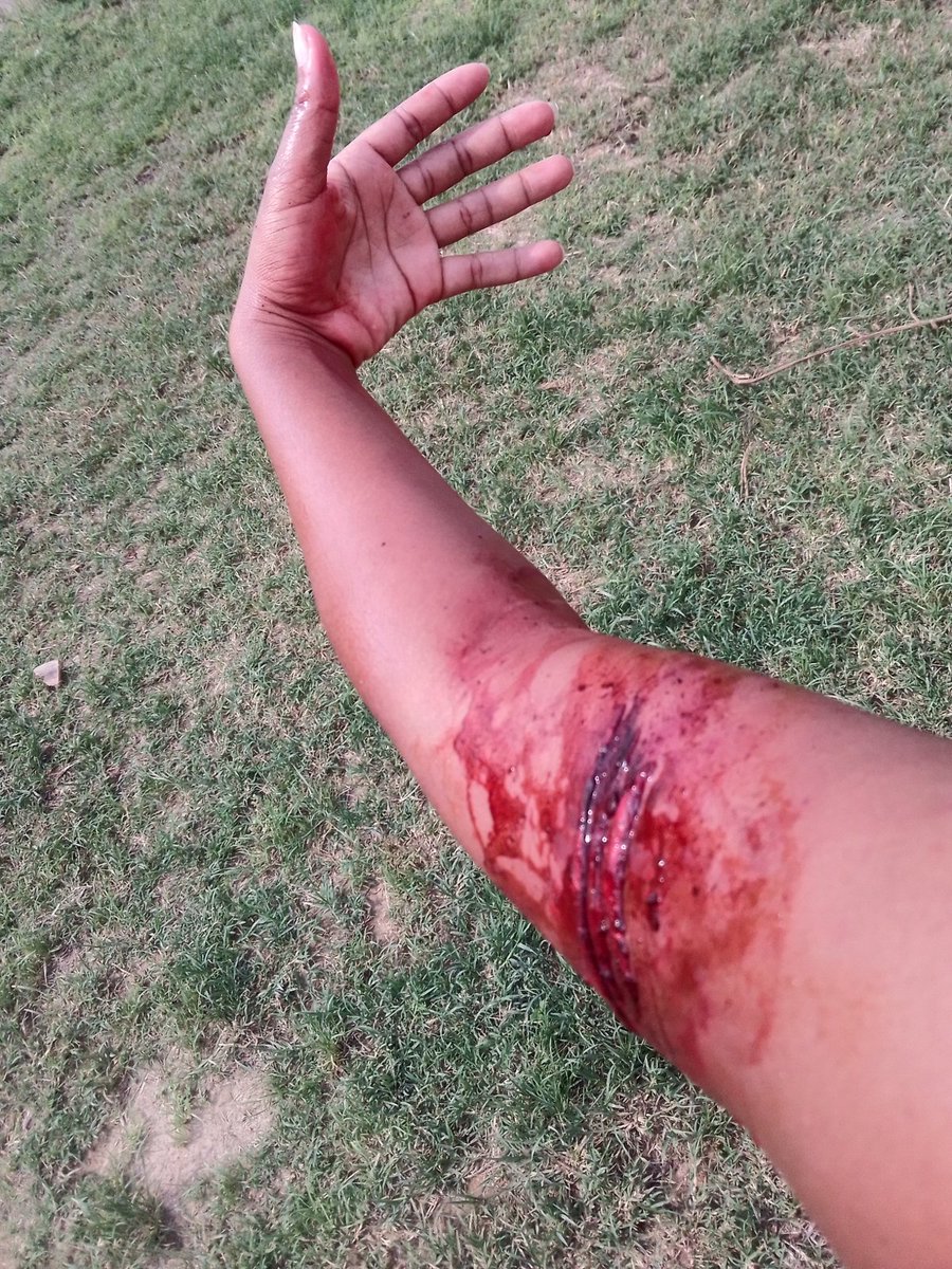 MandisaAshley's tweet photo. Self taught SFX makeup artist 🎨 #justicefornamhla #justiceforhlehle https://t.co/sAyqLrctq8