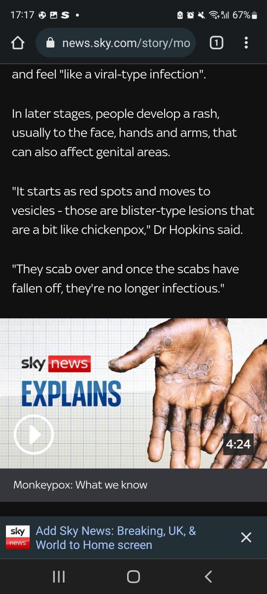 SerahSarah_'s tweet photo. @SkyNews Surely for a disease outbreak in Europe you had to put African/black hands to show. Am I missing something? #SpanishGP #westernmedia #nikujaributu https://t.co/Wd6mApYlts