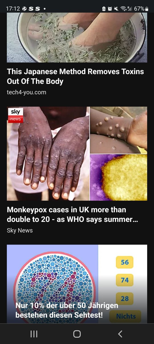 SerahSarah_'s tweet photo. @SkyNews Surely for a disease outbreak in Europe you had to put African/black hands to show. Am I missing something? #SpanishGP #westernmedia #nikujaributu https://t.co/Wd6mApYlts