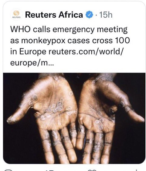 HodoMure's tweet photo. This is what White Supremacy looks like. Using African images for the diseases engulfed in their countries! https://t.co/S5RbqwfN2C