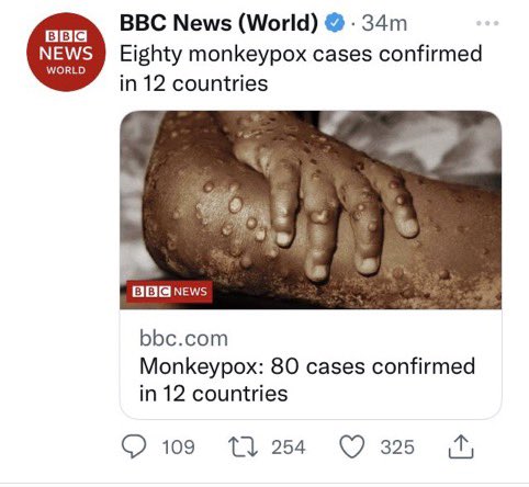 HodoMure's tweet photo. This is what White Supremacy looks like. Using African images for the diseases engulfed in their countries! https://t.co/S5RbqwfN2C