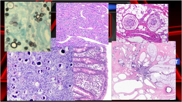 Association of Pathology Chairs (@apcprods) on Twitter photo Are you ready to play Pathology Pyramid? A new #openaccess article in <a href="/AcadPathol/">Academic Pathology</a> by <a href="/Penn/">Penn</a> authors provides explores an alternative method of learning through gaming in #pathology resident education. <a href="/PennPathLabMed/">Penn Path & Lab Medicine</a> doi.org/10.1016/j.acpa… Are you ready to play Pathology Pyramid? A new #openaccess article in <a href="/AcadPathol/">Academic Pathology</a> by <a href="/Penn/">Penn</a> authors provides explores an alternative method of learning through gaming in #pathology resident education. <a href="/PennPathLabMed/">Penn Path & Lab Medicine</a> doi.org/10.1016/j.acpa…
