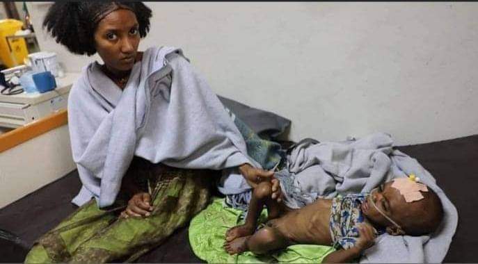 AlghamAnwar's tweet photo. ኣዶ ትግራይ ውላዳ ብስኣን መድሓኒትን ሕፅረት ምግብን

 ንሞት ክሳጣሕ ካብ ምርኣይ ዝከፍእ ስቃይ የለን💔💔

ንሞት ትምነያ ግን ኣይትረክባን 😭😭😭😭😭

#TigrayGenocide 
#tigraywillprevail https://t.co/l9QeeCLBYk https://t.co/gcx1y2oLh9