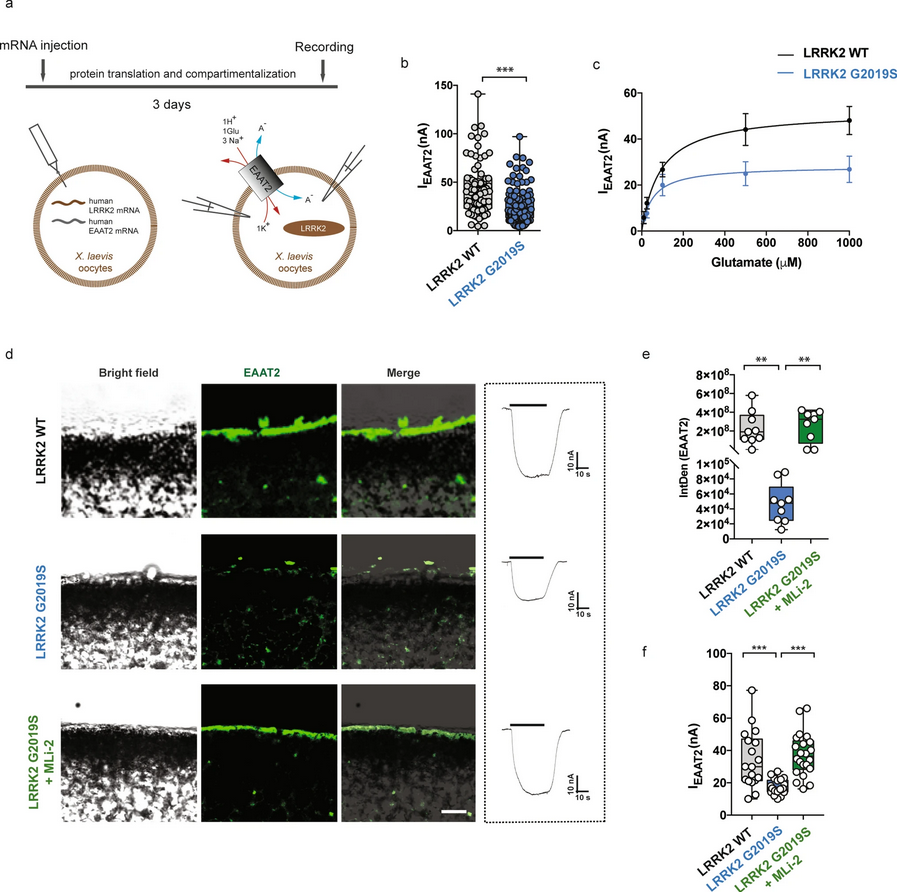 The Science of Parkinson's (@scienceofpd) on Twitter photo New study from <a href="/IovinoLudovica/">Ludovica Iovino</a> <a href="/LauCiviero/">Laura Civiero</a> & colleagues reports that Excitatory Amino Acid Transporter 2 (EAAT2) trafficking is impaired by the #Parkinsons-associated LRRK2-G2019S variant; Could extracellular glutamate overload contribute in LRRK2-PD?
link.springer.com/article/10.100… New study from <a href="/IovinoLudovica/">Ludovica Iovino</a> <a href="/LauCiviero/">Laura Civiero</a> & colleagues reports that Excitatory Amino Acid Transporter 2 (EAAT2) trafficking is impaired by the #Parkinsons-associated LRRK2-G2019S variant; Could extracellular glutamate overload contribute in LRRK2-PD?
link.springer.com/article/10.100…