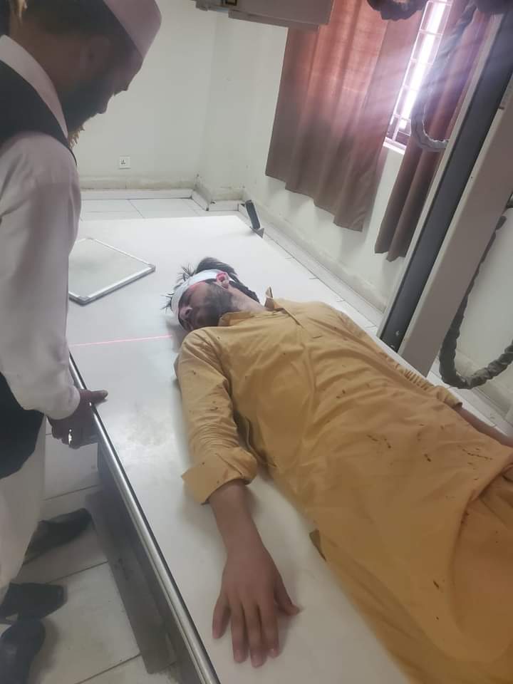 PakhtunSF_UOP's tweet photo. پشتون سٹوڈنٹس فیڈریشن پشاور یونیورسٹی   ہزارہ یونیورسٹی میں پشتون طلبا کے ساتھ ہونے والے تشدد کی بھرپور الفاظ میں مزمت کرتی ہے. ہزارہ یونیورسٹی میں یہ واقعات معمول بن چکی ہیں یونیورسٹی اور  ضلعی انتظامیہ کی مجرمانہ خاموشی اس طرح کے واقعات کو مزید تقویت دے گی ۔ https://t.co/k0rbFEFgnm