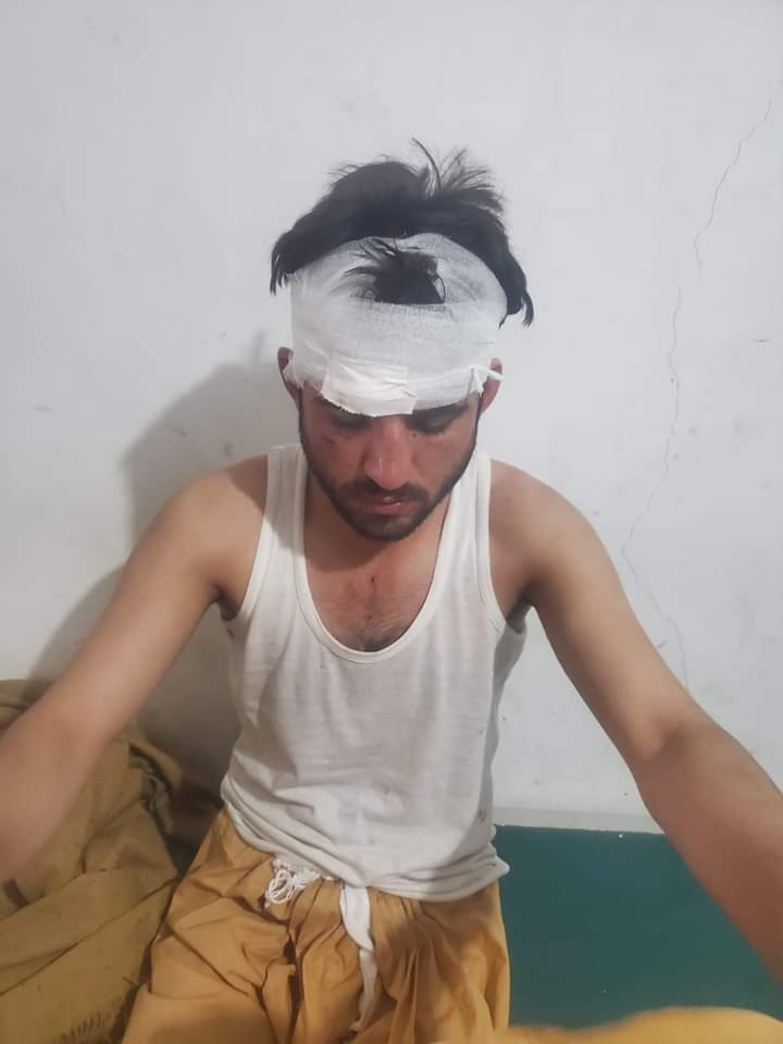 PakhtunSF_UOP's tweet photo. پشتون سٹوڈنٹس فیڈریشن پشاور یونیورسٹی   ہزارہ یونیورسٹی میں پشتون طلبا کے ساتھ ہونے والے تشدد کی بھرپور الفاظ میں مزمت کرتی ہے. ہزارہ یونیورسٹی میں یہ واقعات معمول بن چکی ہیں یونیورسٹی اور  ضلعی انتظامیہ کی مجرمانہ خاموشی اس طرح کے واقعات کو مزید تقویت دے گی ۔ https://t.co/k0rbFEFgnm