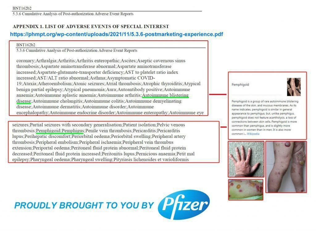estrad_i's tweet image. Literally Vaccine induced side effect

stop covering for Pfizer