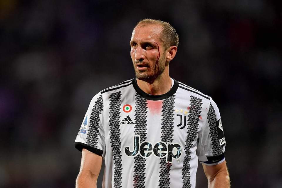 JuventusFR_'s tweet photo. Rien de plus symbolique qu'un #Chiellini en sang. 🩸 😅 https://t.co/pFhrcZrTd1