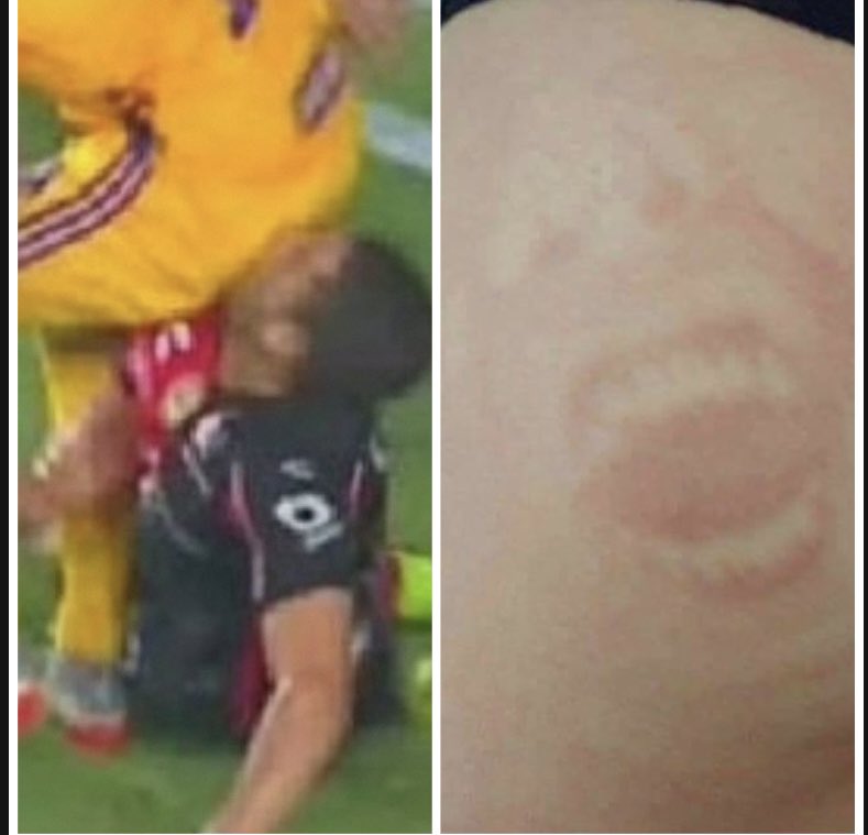 albertgrump's tweet photo. Nuevo Tattoo de @10APG   Si fue penal..#Tigres https://t.co/RnfBslCjE0