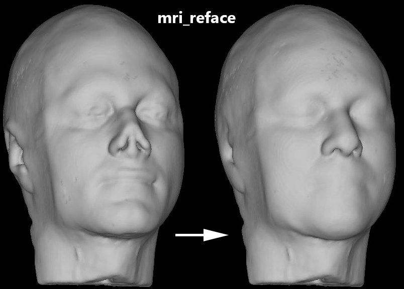 nitrc_info's tweet photo. mri_reface replaces identifiable face information in MRI scans to help prevent re-identification via face recognition. Faces are replaced with an average face to reduce effects on downstream brain measurement software. https://t.co/GQjLuGXUaA #MRI #OpenScience https://t.co/ix0x6GWedk
