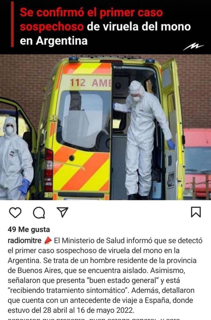 carayarez2021's tweet photo. @medinalorca @SalvadorPuccio @tvc_chile  Qué Rápido se Propagan los #Virus de Un Continente a Otro✈️ o Será que Vienen en Las #Vqnas 💉 #Oxford #AstraZeneca #MataEstrellas #Vqna #VectorViral Elaborada Con #Adenovirus de #Chimpance 🐵 #ViruelaDelMono 🐒 en #Europa 🇪🇺y #Argentina🇦🇷 https://t.co/ZYAXDLuXZx