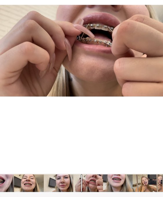 Very soon on MV 🔥🖤 fetish video with my braces with a lot of elastics close up 🔥🖤 https://t.co/wyCoU