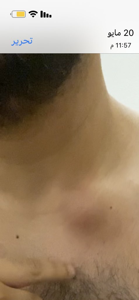 سعد المالكي 🎗 tweet media