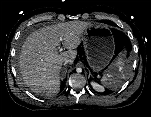 Junior Radiologie Interventionnelle tweet media