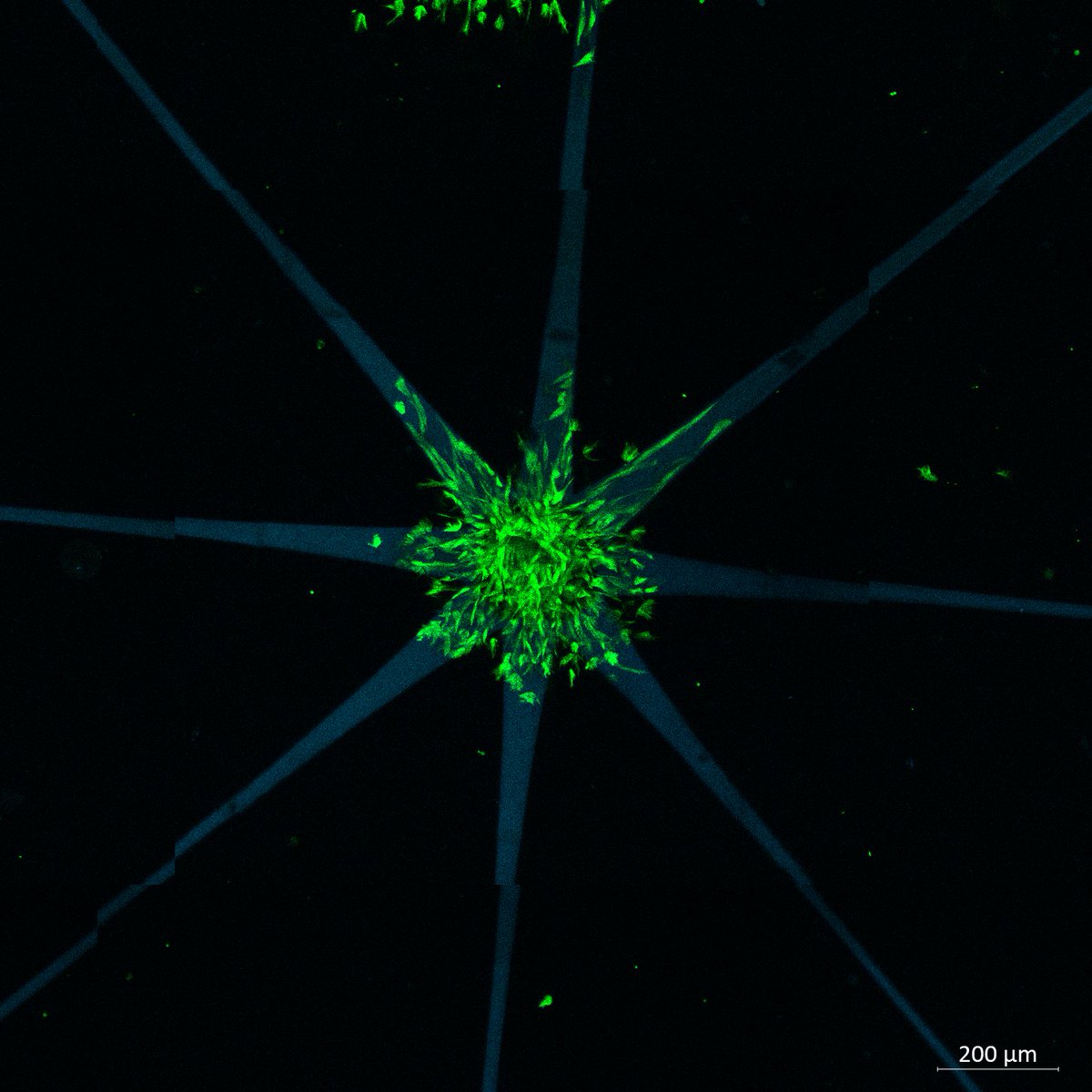 Mit dem Laserstrahl gibt man an der TU Wien Zellen vor, wohin sie wachsen sollen. So kann man künstliches Gewebe maßschneidern - etwa für tierversuchsfreie Pharma-Forschung. #3dprint #Bioprinting #Nanotech tuwien.at/tu-wien/aktuel…