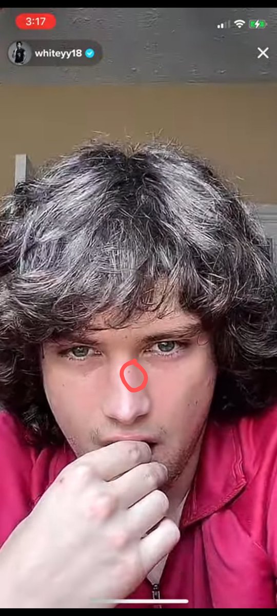 Nikig_18's tweet photo. Since we are talking about weird obsessions, any one else obsessed with his freckles/moles?? It's these ones for me!! #freaklikeme #weirdobsessions #sexymf https://t.co/nCBwTL2bWx