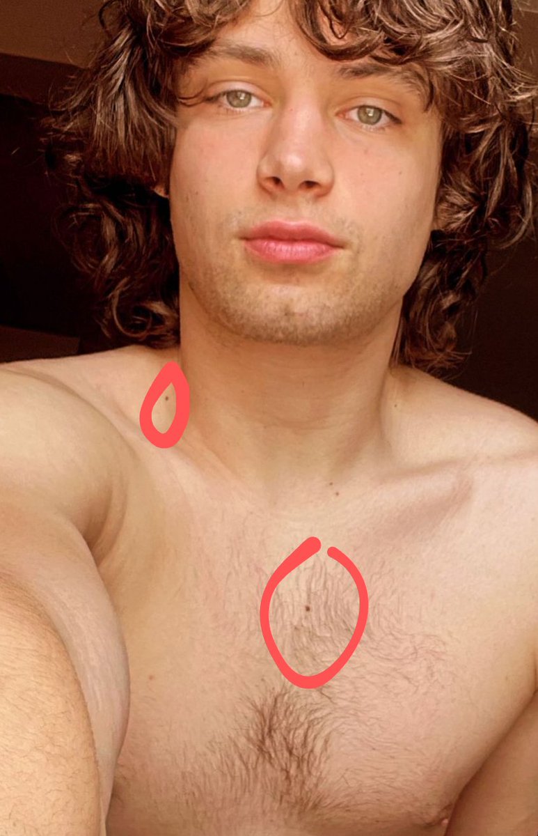 Nikig_18's tweet photo. Since we are talking about weird obsessions, any one else obsessed with his freckles/moles?? It's these ones for me!! #freaklikeme #weirdobsessions #sexymf https://t.co/nCBwTL2bWx