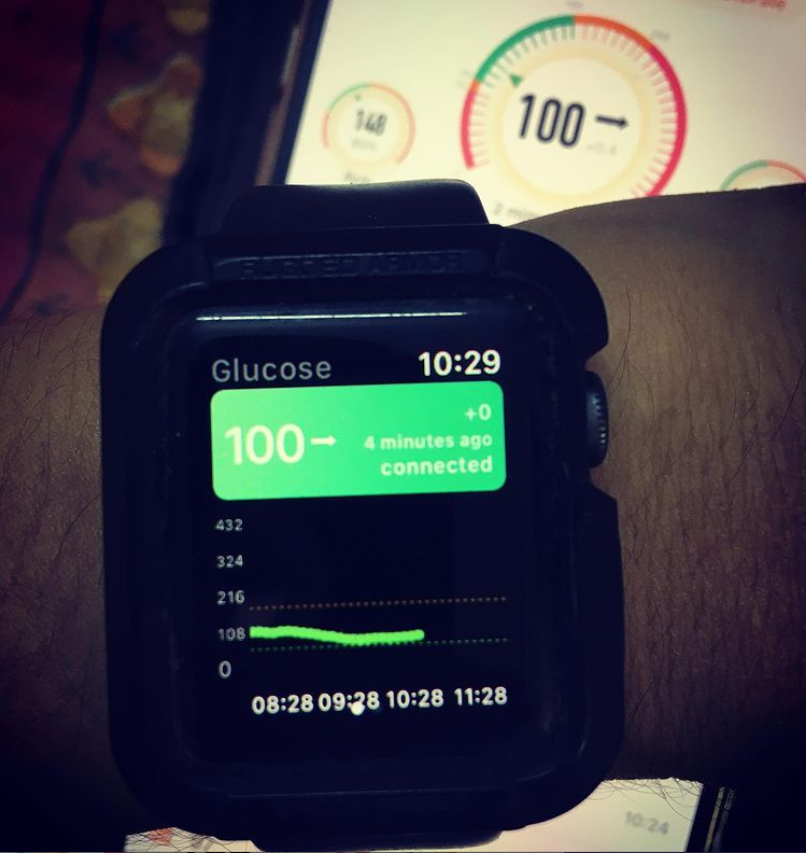 miaomiao_reader's tweet photo. @imtyp1d miaomiao+tomato app+watch
#freestylelibre #type1diabetic #type1strong #diabeteslife #t2d #miaomiao2 #miaomiao3 #diabetescommunity #diabeticproblems #fuckdiabetes #beyondtype1 #freestylelibrestechnology #diabetesawards https://t.co/T1fLkMYTTi