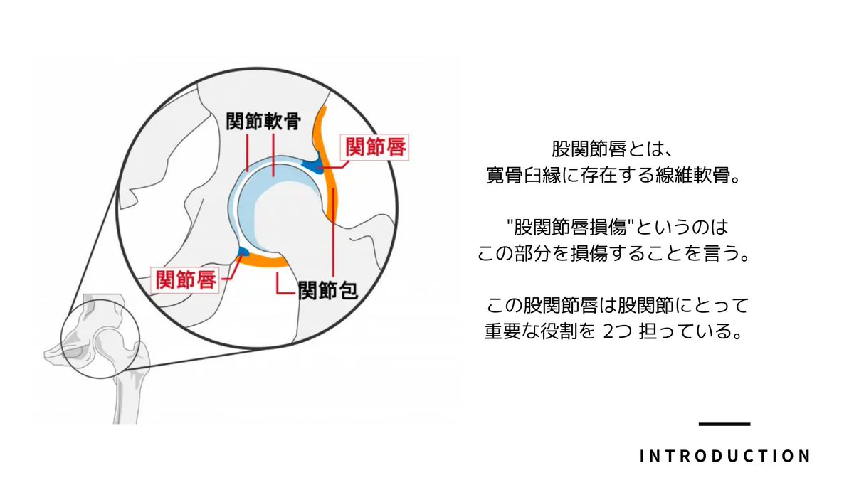 TakumiRodrigues's tweet photo. 痛覚、深部感覚、MRI、各種special test（FADIR、FABER、log roll test etc..）の結果を包括的に捉える必要があります⇓ https://t.co/IbdNTkv0OA