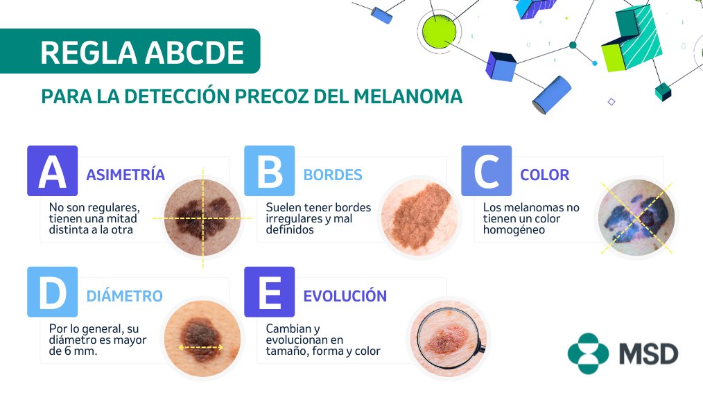 MSDEspana's tweet photo. Como parte de nuestro compromiso con la investigación contra el #cáncer, desde #MSDEspaña queremos sumarnos al #DiaMundialMelanoma que se celebra hoy. Recuerda que la regla ABCDE es una clave poderosa para su detección precoz 👇 https://t.co/Yb04L6y48J