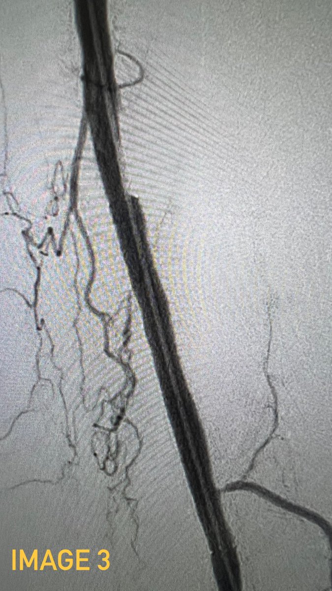 Interventional Radiology RPH tweet media