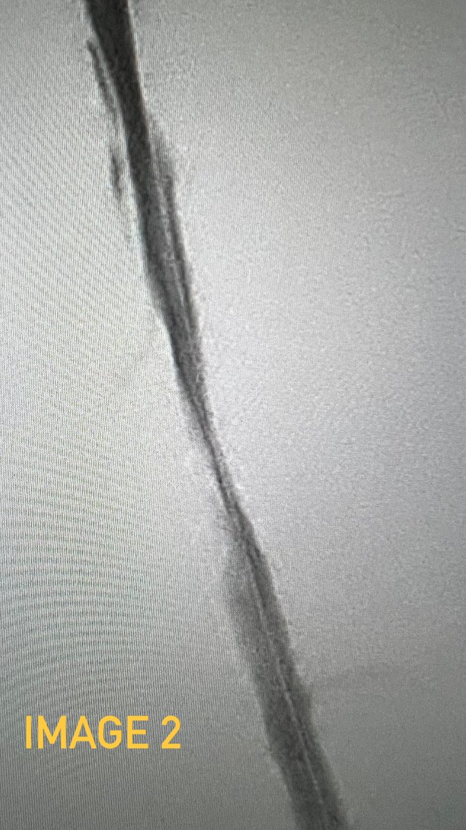 Interventional Radiology RPH tweet media