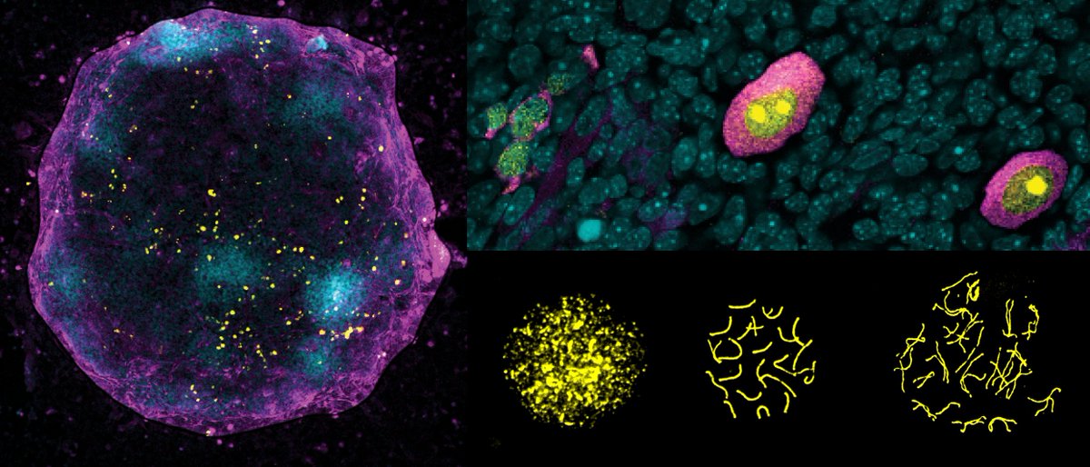 Centre for Genomic Regulation (CRG) (@crgenomica) on Twitter photo 📚Turning X chromosome “off and on again” critical for oocyte development
Researchers at the#CRG have identified a potential new diagnostic marker that predicts the successful and efficient development of mammalian egg cells. The research is published in <a href="/embojournal/">The EMBO Journal</a> 📚Turning X chromosome “off and on again” critical for oocyte development
Researchers at the#CRG have identified a potential new diagnostic marker that predicts the successful and efficient development of mammalian egg cells. The research is published in <a href="/embojournal/">The EMBO Journal</a>