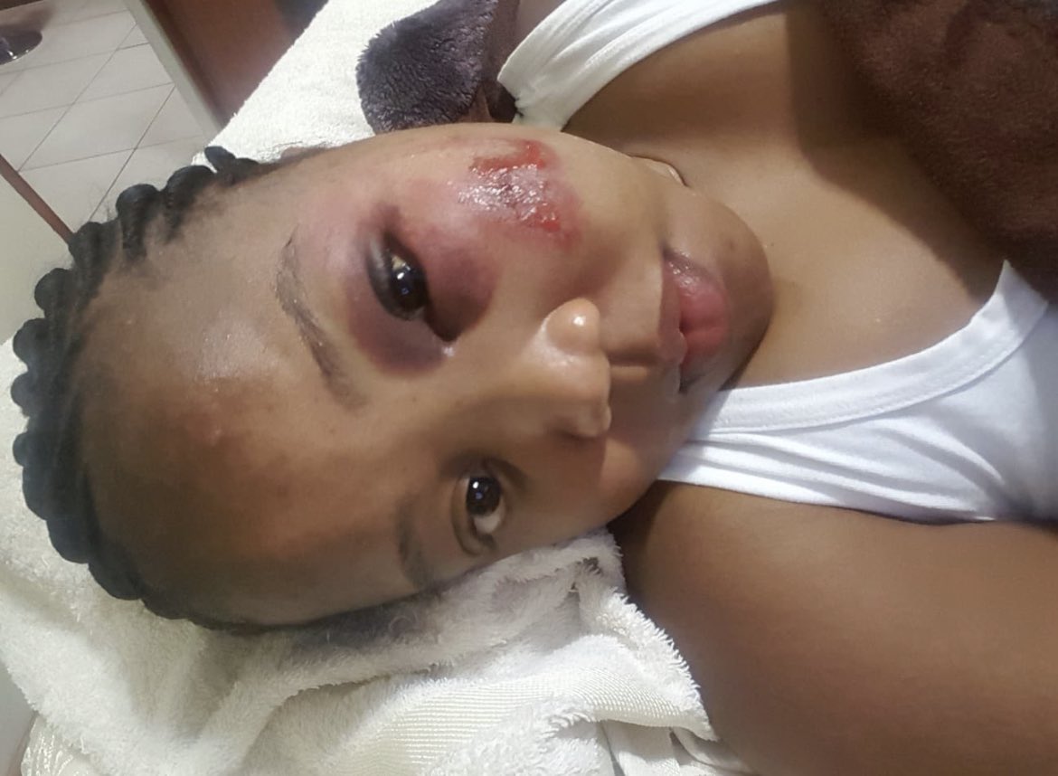 AmandaDupont's tweet photo. Protect woman’s rights! We are not animals. Namhla a true hero leaving evidence behind because she knew she might not make it out alive. She deserves justice. We are tired, scared and fearful. We speak for those who never make it out alive at the hands of GBV. #justicefornamhla https://t.co/ecD9fguuCY