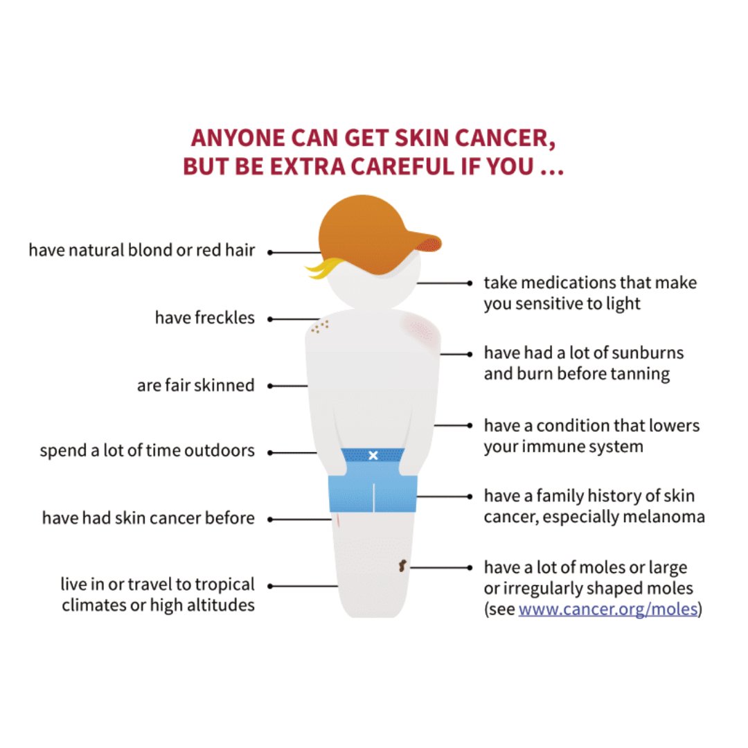 Skin cancer is by far the most common type of cancer. #DYK the risks? Take this quiz to find out! ow.ly/6ytX50J9VUT
 #Melanoma Monday