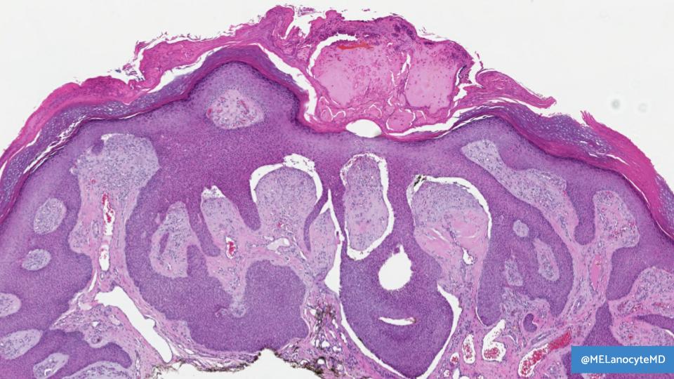 Melanie Bourgeau, MD tweet media