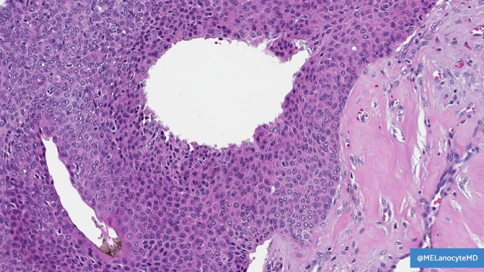 Melanie Bourgeau, MD tweet media