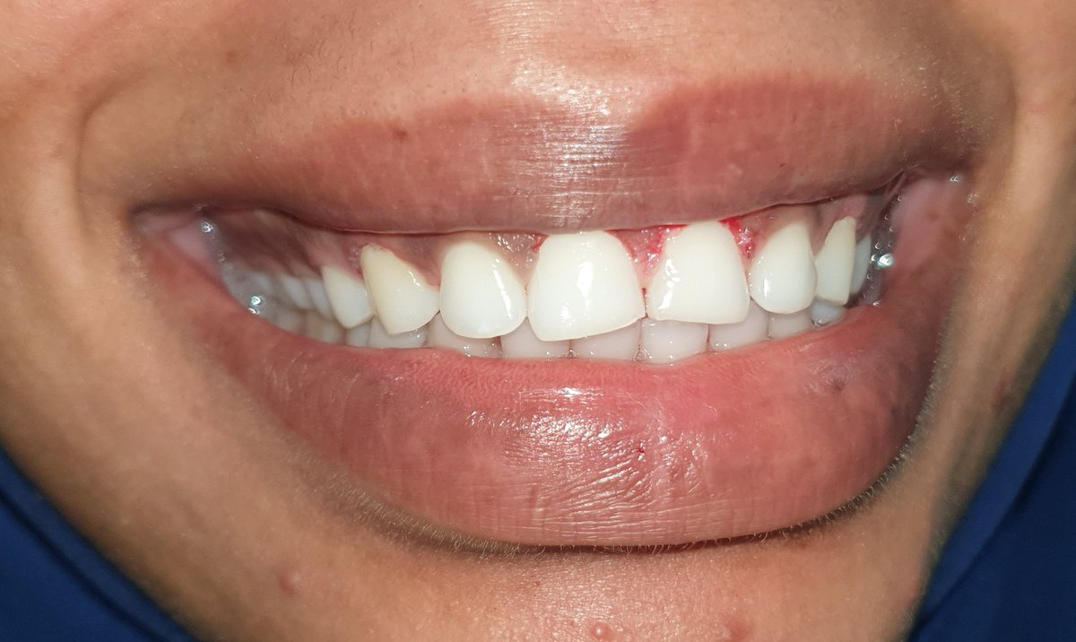 mustafa kurdi tweet media