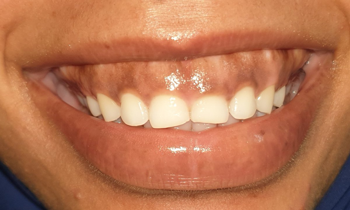 mustafa kurdi tweet media