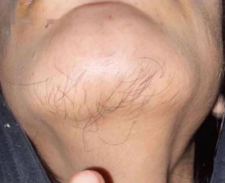 DenzelUG's tweet photo. Sometimes all you need is @goateebeardcare distributed by @LaditUg +256 780 208 936 https://t.co/lBa3hGHONv