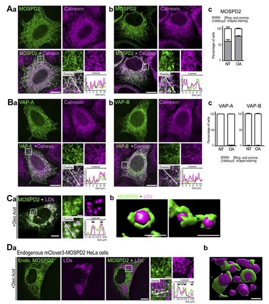 IGBMC (@igbmc) on Twitter photo <a href="/AlpyFabien/">Fabien ALPY</a>, from <a href="/CTomasetto/">Catherine Tomasetto</a>'s lab, was interviewed by <a href="/Inserm/">Inserm</a> on their paper about MOSPD2 #protein, responsible for contacts between the endoplasmic reticulum and the #lipid droplets.
👨🔬 The interview here : bit.ly/3NutH8t
📕 Original article : bit.ly/3sN1928 <a href="/AlpyFabien/">Fabien ALPY</a>, from <a href="/CTomasetto/">Catherine Tomasetto</a>'s lab, was interviewed by <a href="/Inserm/">Inserm</a> on their paper about MOSPD2 #protein, responsible for contacts between the endoplasmic reticulum and the #lipid droplets.
👨🔬 The interview here : bit.ly/3NutH8t
📕 Original article : bit.ly/3sN1928