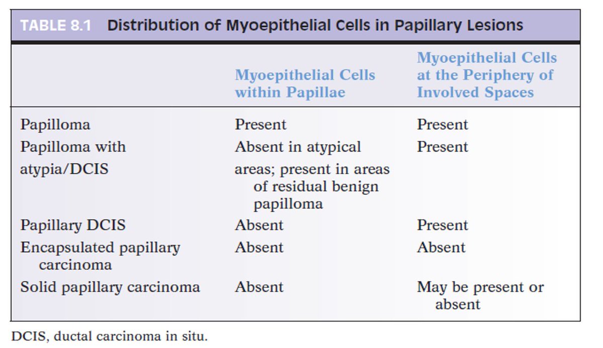 Ahmad_Hawkeye's tweet photo. Distribution of myoepithelial cells in papillary lesions of the breast
#BreastPath #pathboards 

Image courtesy: Breast biopsy interpretation book. https://t.co/ltEY5wUuHY