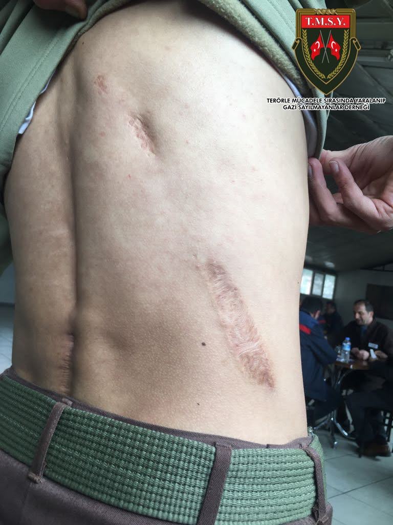 Terörle mücadele sırasında yaralanıp gazi sayılmayan 20bin vatan evladını görmezden gelip gazilik ünvanı vermeyenler.Asker kaçaklarına müjde veriyor.Müjdeniz batsın.<a href="/RTErdogan/">Recep Tayyip Erdoğan</a> <a href="/Akparti/">AK Parti</a> <a href="/MHP_Bilgi/">MHP</a> <a href="/dbdevletbahceli/">Devlet Bahçeli</a> <a href="/UlviYonter/">Dr.İzzet Ulvi YÖNTER</a> <a href="/TmsyGaziler/">T.M.S.Y GAZİ SAYILMAYANLAR</a> <a href="/tcailesosyal/">T.C. Aile ve Sosyal Hizmetler Bakanlığı</a> "Sayıları 550"