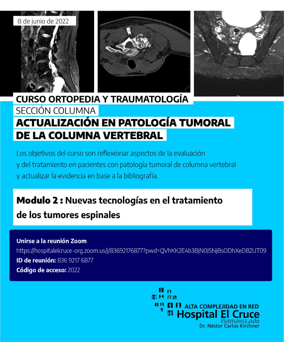 ElCruceHospital's tweet photo. 📚 HEC Universitario 📚

Curso:
“Actualización en patología tumoral de la columna vertebral”. Inicia módulo 2

🤓 Dirigido a médic@s con residencia finalizada. 

🔗 Inscripción 👇: 
https://t.co/r5NaZFUzFg

  Numero de reunión: 836 9217 6877
  Contraseña: 2022 https://t.co/J38IWFJl8n