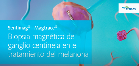Sysmex_Es's tweet photo. En 2021 se detectaron más de 6000 casos de #melanoma. Hoy, #DíaMundialdelMelanoma, desde #Sysmex recomendamos realizar revisiones periódicas para prevenir su aparición. Nuestro trazador #Magtrace detecta los ganglios centinela del melanoma. Más información:https://t.co/X7ljERfUv2 https://t.co/g2xBONRWCw
