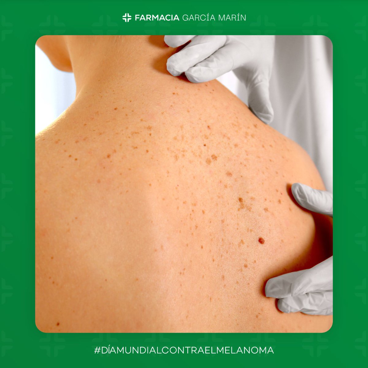 farmaciagarciam's tweet photo. 🗓️ Aprovechamos el Día Mundial contra el #Melanoma para recordarte la importancia de la #fotoprotección 🔆

☀️ Los rayos #UVA y #UVB son los causantes de la #pigmentación y también de los cánceres de la piel.

🧴 Por ello, #protégete siempre y evita a toda costa las #quemaduras. https://t.co/B5SXvjfLCw