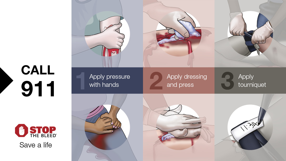 #DYK: No prior experience in healthcare is needed to take a #STOPTHEBLEED course? Anyone can learn the lifesaving skills needed to help bleeding patients until medical professionals arrive. Find a course near you: stopthebleed.org