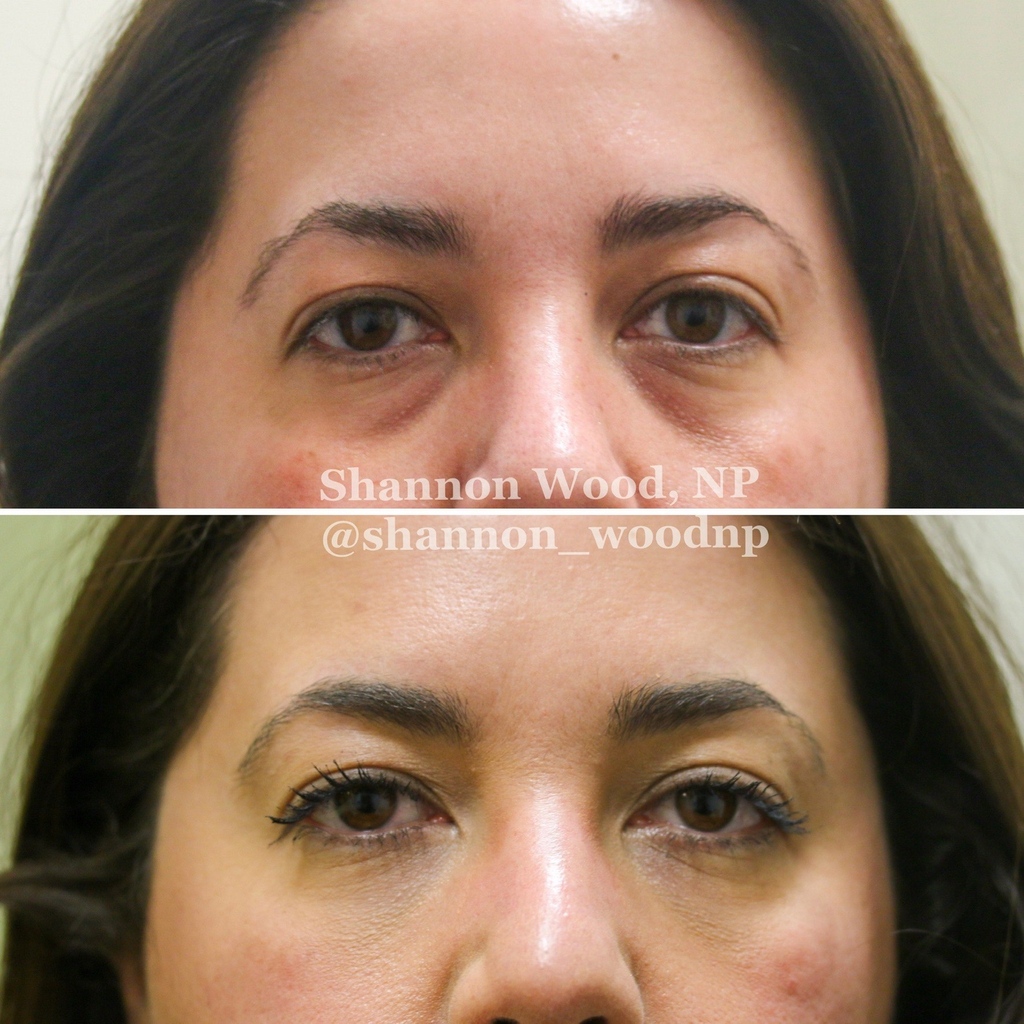 Nayak Plastic Surgery & Avani Derm Spa tweet media