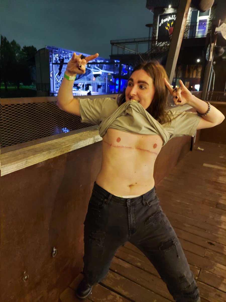 BattyJamie24's tweet photo. @PortableMoose FINALLY getting top surgery! Oh, and achieving a goal of mine to see @DWTDmusic in concert as your #LarryFace 🤘💀 https://t.co/99FKTAHozo