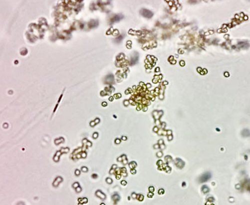 Can you spot the lonely diatom? #planktoscope #nwabcp