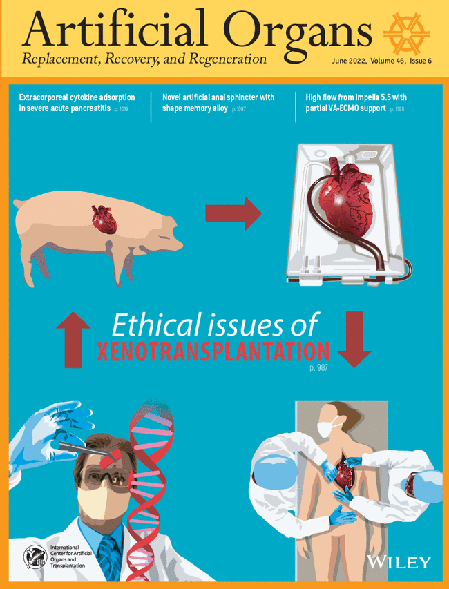 Artificial Organs tweet media