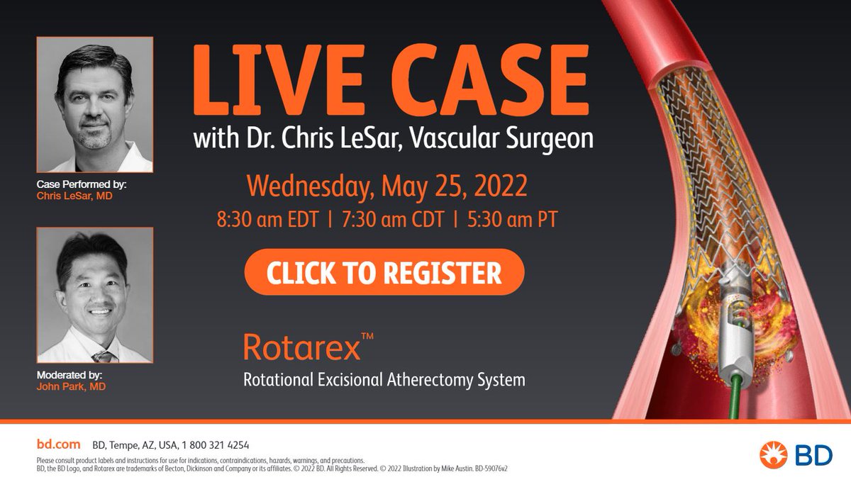 BDandCo_PI's tweet photo. Join BD for a live case utilizing the Rotarex™ Atherectomy Device on May 25th with Dr. LeSar moderated by Dr. Park #RemoveWithRotarex. Click here to register: https://t.co/BrJTurJcP6 https://t.co/H2dpWm3E21