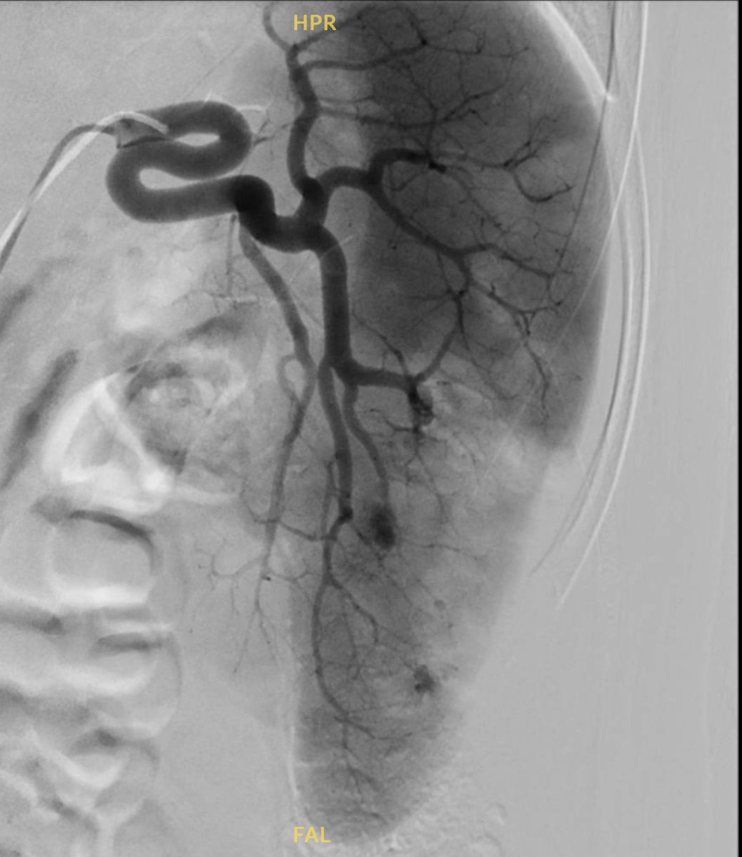Junior Radiologie Interventionnelle tweet media